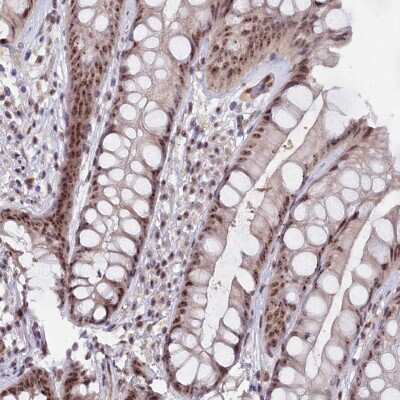 Immunohistochemistry-Paraffin: C1D Antibody [NBP2-48673]
