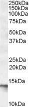 Western Blot: C1D Antibody [NBP1-06982]