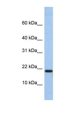 Western Blot: C1D Antibody [NBP1-79372]