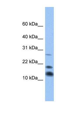 Western Blot: C1D Antibody [NBP1-79373]