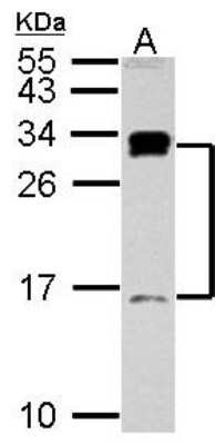 Western Blot: C1D Antibody [NBP2-15639]