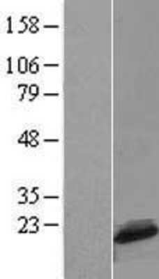 Western Blot: C1D Overexpression Lysate [NBL1-08285]