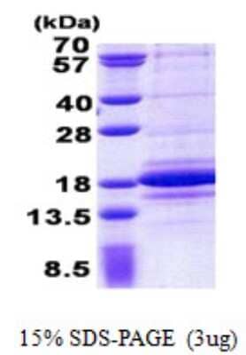 SDS-PAGE: Recombinant Human C1D His Protein [NBP2-22721]