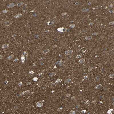 Immunohistochemistry-Paraffin: C1GALT1 Antibody [NBP1-88476]