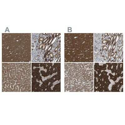 Immunohistochemistry-Paraffin: C1GALT1 Antibody [NBP1-88476]