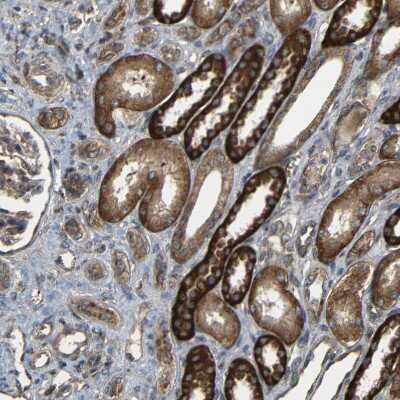 Immunohistochemistry-Paraffin: C1GALT1 Antibody [NBP1-88476]
