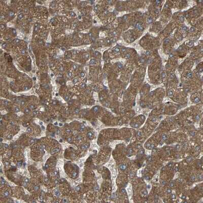 Immunohistochemistry-Paraffin: C1GALT1 Antibody [NBP1-88476]