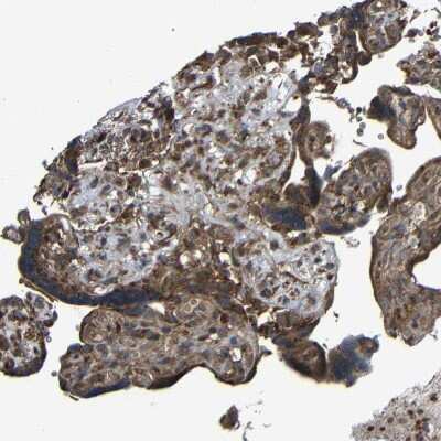 Immunohistochemistry-Paraffin: C1GALT1 Antibody [NBP1-88476]