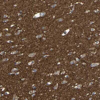 Immunohistochemistry-Paraffin: C1GALT1 Antibody [NBP1-88477]