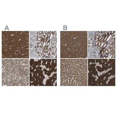 Immunohistochemistry-Paraffin: C1GALT1 Antibody [NBP1-88477]