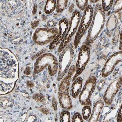 Immunohistochemistry-Paraffin: C1GALT1 Antibody [NBP1-88477]