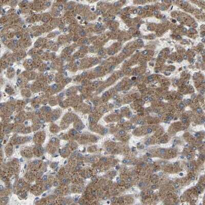 Immunohistochemistry-Paraffin: C1GALT1 Antibody [NBP1-88477]