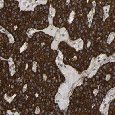 Immunohistochemistry-Paraffin: C1GALT1 Antibody [NBP1-88477]