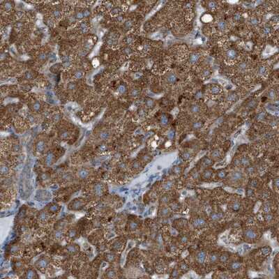 Immunohistochemistry-Paraffin: C1GALT1C1 Antibody [NBP1-88478]