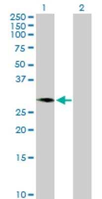 Western Blot: C1GALT1C1 Antibody [H00029071-B01P]