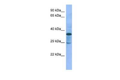 Western Blot: C1GALT1C1 Antibody [NBP2-84545]