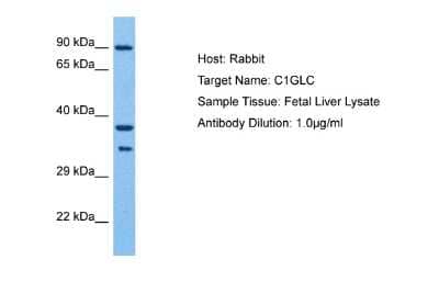 Western Blot: C1GALT1C1 Antibody [NBP2-84546]