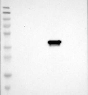 Western Blot: C1GALT1C1 Antibody [NBP3-17811]