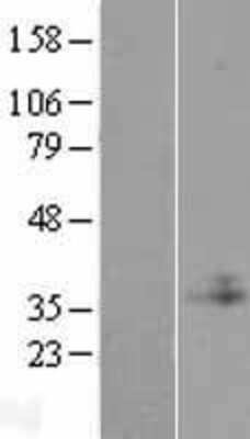 Western Blot: C1GALT1C1 Overexpression Lysate [NBP2-09138]