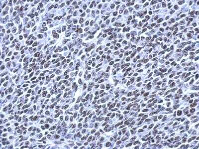 Immunohistochemistry-Paraffin: RSRP1 Antibody [NBP2-15641]
