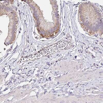 Immunohistochemistry-Paraffin: RSRP1 Antibody [NBP2-32411]