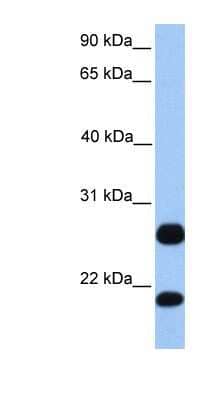 Western Blot: RSRP1 Antibody [NBP1-70455]