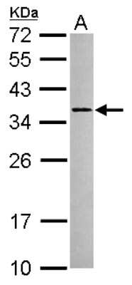 Western Blot: RSRP1 Antibody [NBP2-15641]