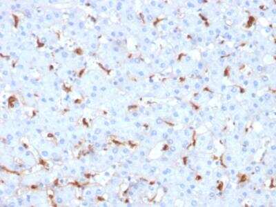 Immunohistochemistry-Paraffin: C1QB Antibody (C1QB/2961) - Azide and BSA Free [NBP2-79920]