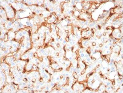 Immunohistochemistry-Paraffin: C1QB Antibody (C1QB/2965) - Azide and BSA Free [NBP2-79921]