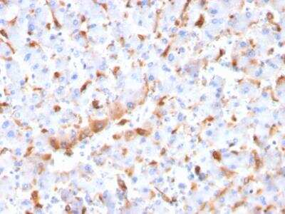 Immunohistochemistry-Paraffin: C1QB Antibody (C1QB/2966) - Azide and BSA Free [NBP2-79922]