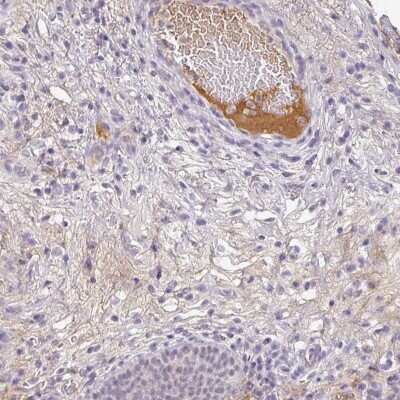 Immunohistochemistry: C1QB Antibody [NBP2-49033]