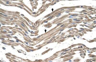 Immunohistochemistry-Paraffin: C1QB Antibody [NBP1-59056]