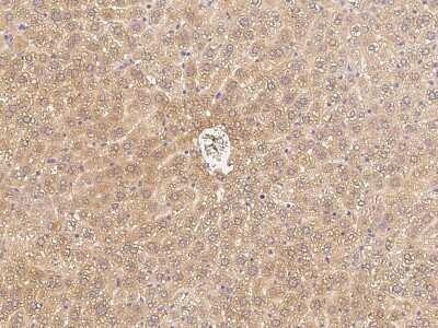 Immunohistochemistry-Paraffin: C1QB Antibody [NBP2-99263]