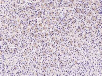 Immunohistochemistry-Paraffin: C1QB Antibody [NBP2-99263]