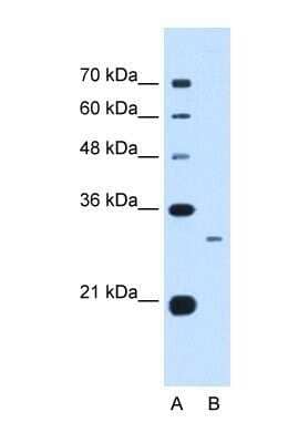 Western Blot: C1QB Antibody [NBP1-59056]