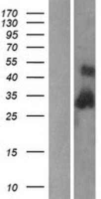 Western Blot: C1QB Overexpression Lysate [NBP2-09018]