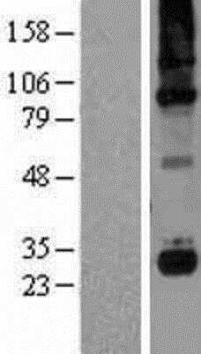 Western Blot: Complement Component C1qC Overexpression Lysate [NBP2-09393]