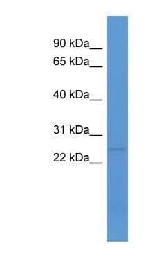 Western Blot: C1QL1 Antibody [NBP1-68909]