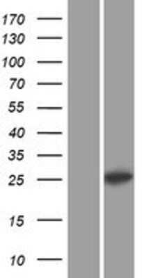 Western Blot: C1QL1 Overexpression Lysate [NBP2-07593]