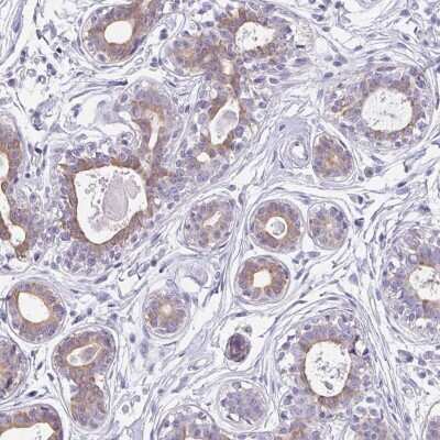 Immunohistochemistry-Paraffin: C1QTNF8 Antibody [NBP2-34167]