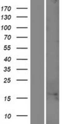 Western Blot: C1orf100 Overexpression Lysate [NBP2-08709]