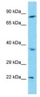 Western Blot: C1orf105 Antibody [NBP3-10738]