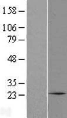 Western Blot: C1orf105 Overexpression Lysate [NBL1-08290]