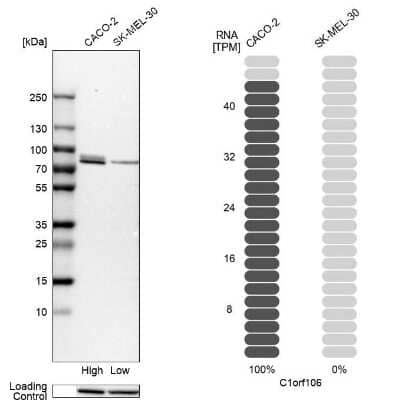 Western Blot: INAVA Antibody [NBP1-90424]