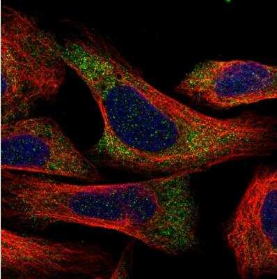 Immunocytochemistry/ Immunofluorescence: C1orf109 Antibody [NBP1-82175]