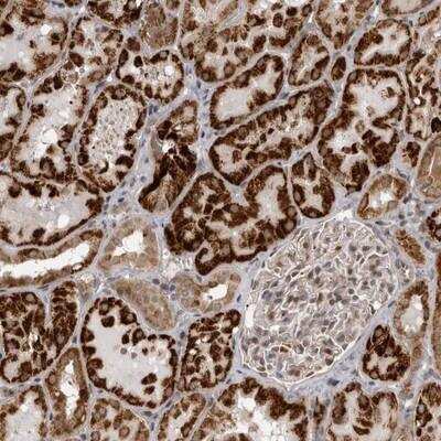 Immunohistochemistry: C1orf109 Antibody [NBP1-82176]