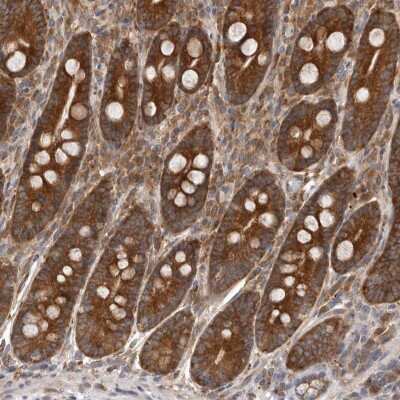 Immunohistochemistry-Paraffin: C1orf109 Antibody [NBP1-82175]