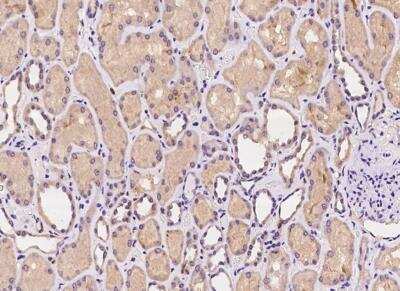Immunohistochemistry-Paraffin: C1orf109 Antibody [NBP3-05934]