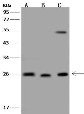 Western Blot: C1orf109 Antibody [NBP3-05934]