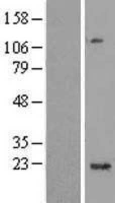 Western Blot: C1orf109 Overexpression Lysate [NBL1-08292]